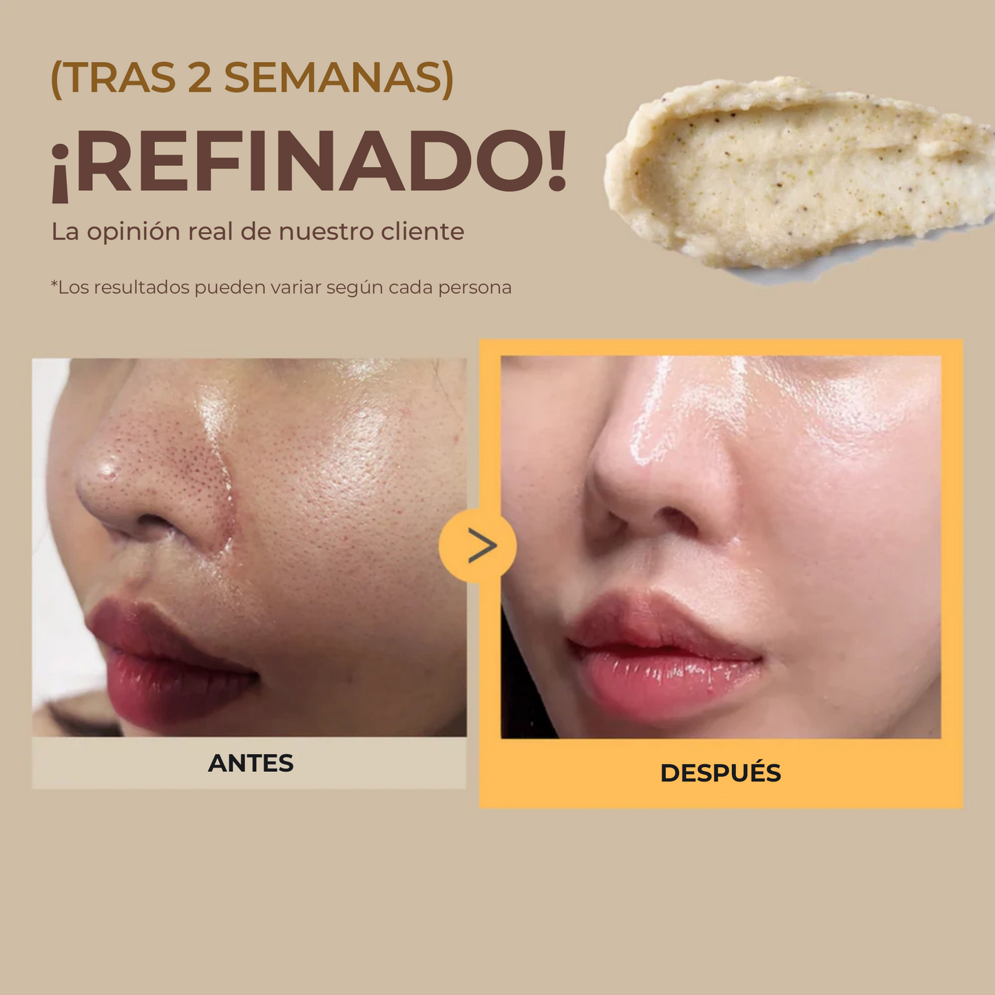 MOMMY CARE Potato Wash Off Pack 100g – Mascarilla Facial Coreana con Extracto de Papa para Purificar, Abrir y Reducir Poros
