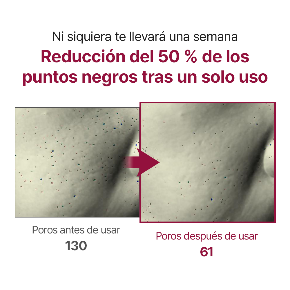 MOMMY CARE Red Bean Enzyme Cleanser 50g – Limpiador Facial Suave con Extracto de Frijol Rojo para Poros Limpios y Piel Equilibrada