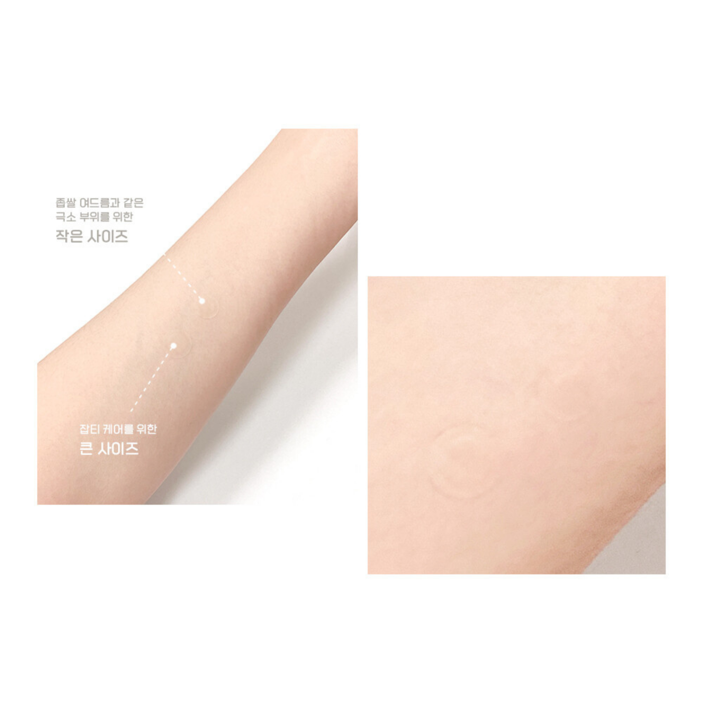 ORJENA EASY CARE COVER PATCH