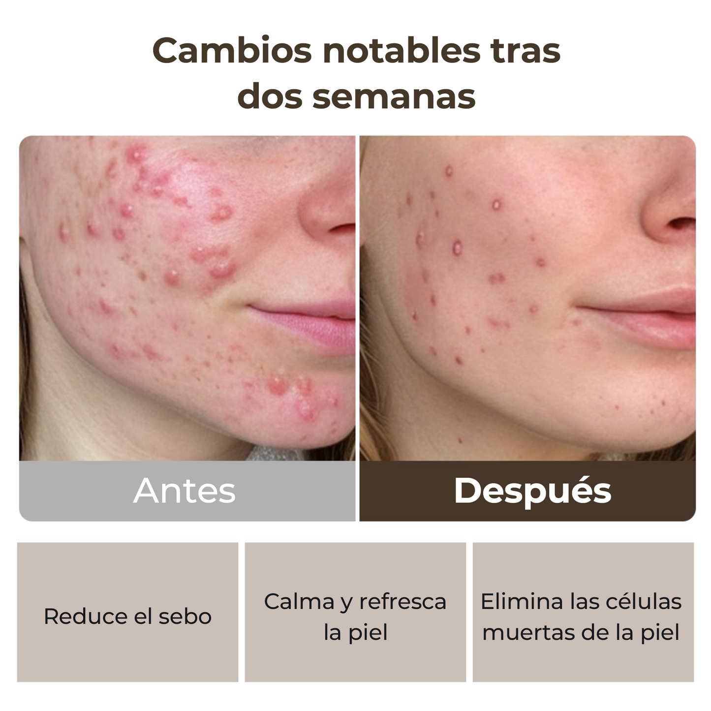 MOMMY CARE Potato Wash Off Pack 100g – Mascarilla Facial Coreana con Extracto de Papa para Purificar, Abrir y Reducir Poros